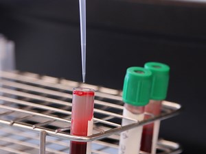 Measuring Granulocyte and Monocyte Phagocytosis and Oxidative Burst Activity in Human Blood