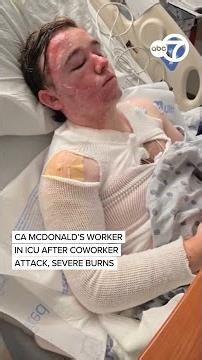 McDonald's worker in CA in ICU after coworker allegedly throws hot oil, causing severe burns