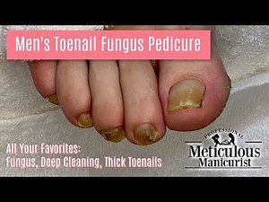 Pedicure Transformation with All Your Favorites - Fungus, Deep Cleaning, Thick Toenails