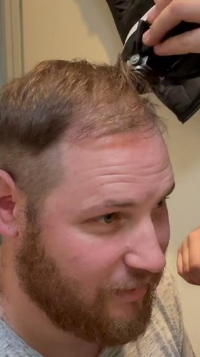 BALDING Man First Time Shaving Head BALD #shorts