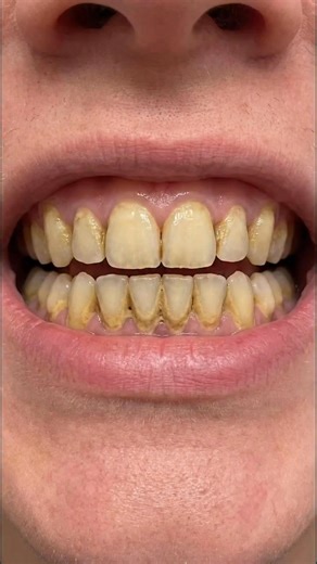 10 YEARS of rust gone in 10 SECONDS. Can you believe it? 👀 🛒 Check it out: premierusmart.com/product/removerspray/ #rustremoval #oddlysatisfying #transformation #cleaning #wow | ATL Tool Talk