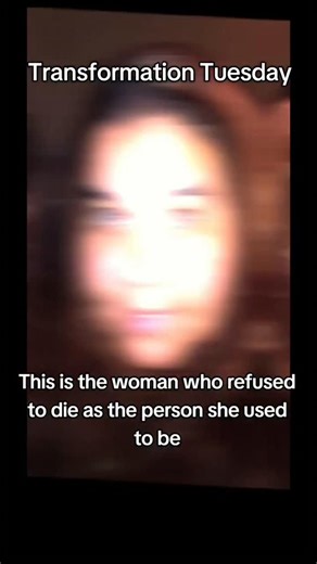 Draya on Instagram: "Drop a 💗 if this hit you in the chest. Comment ‘I’m next’ if you’re claiming your transformation starting today. I’ll reply back.... you’re not doing this alone. #TransformationTuesday #EmotionalTransformation #RawAndReal #BariatricJourney #DuodenalSwitch #370PoundsDown #MyWhy #WeightLossStory #MassiveWeightLoss #HealingMyLife #BariatricSupport #RestartYourJourney #DeterminedDraya #DeterminedCrew #BariatricCommunity #BeforeAndAfterStory #YouAreWorthIt"