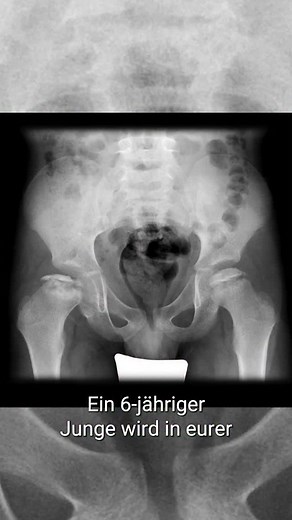 Worunter könnte der 6-jährige Junge mit den Schmerzen in Oberschenkel und Knie leiden? Ratet mit! Mehr dazu gibt es im Flexikon. LINK IN DER BIO! | DocCheck