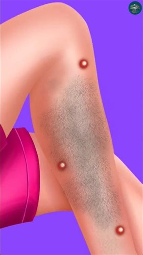 Extreme Leg Cleaning ASMR 😬 | Deep Dirt Removal & Pimple Popping | Satisfying Transformation #shorts