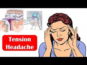Tension Headache - Causes, Signs & Symptoms, And Treatment