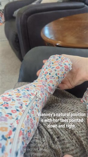 1.5K views · 102 reactions | When Vianney’s foot is at rest, her toes...