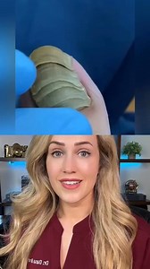 Doctor reacts to a layered toenail | Footdocdana