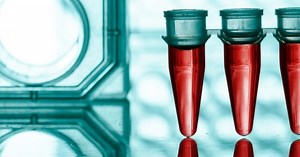 Pharmaceutical Nanotechnology | University of Helsinki