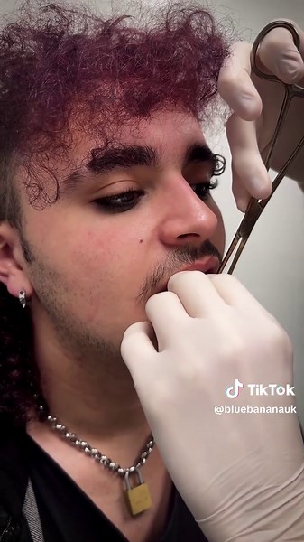 Thinking about getting a snake bite piercing? A Snake Bite piercing is a great choice for something a little different, with two piercings placed on either side of your lower lip. It’s a striking look that’s both edgy and customisable once healed, with options like labrets, rings, or circular barbells. While the pain is usually mild (about a 4-5 / 10). Healing typically takes 2-3 months, but it depends on the person and your aftercare. The key is to keep it clean and avoid messing with the jewel