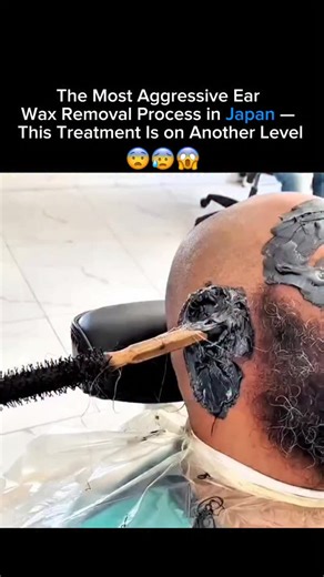 AFFILIX FINDS on Instagram: "Ear cleaning traditions around the world are wildly different, and Japan is known for some of the most unique methods. This aggressive ear-wax removal technique uses a thick, fast-drying black mask that sticks to every layer of wax, dust, and dead skin around the ear. When it hardens, it’s pulled off in one strong motion, removing everything stuck inside. People say it feels painful for a second, but extremely satisfying afterward. Treatments like this are popular be