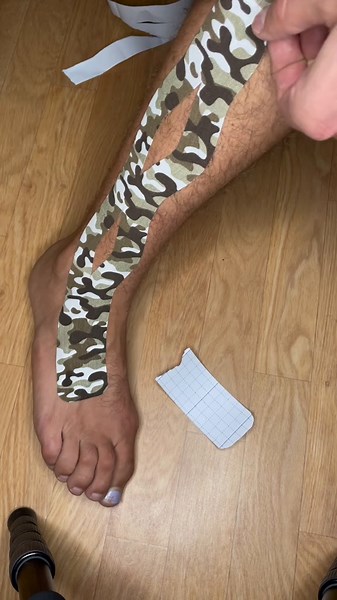 Taping Techniques for Extensor Tendonitis Relief