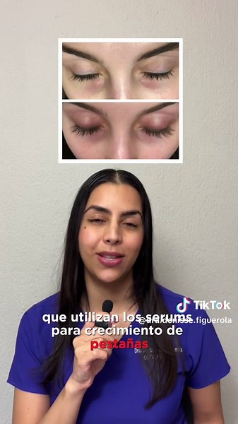 Efectos Secundarios de los Sérums para Pestañas
