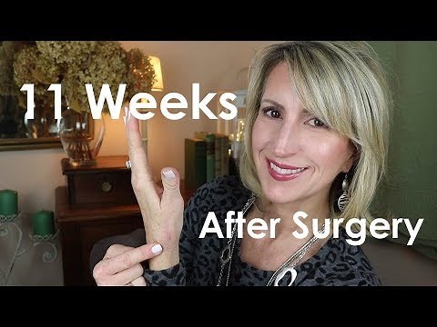BASAL JOINT ARTHRITIS SURGERY - 11 WEEKS AFTER SURGERY