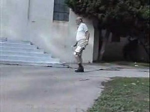 Hyperextension of the Knee