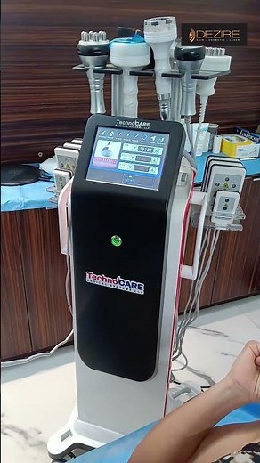 360 Abdomen Liposuction RF Session