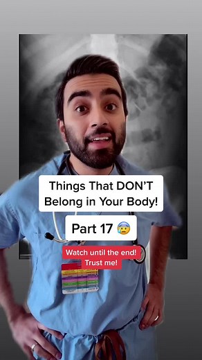 Foreign Objects in X-ray: Things That DON’T Belong in Your Body!