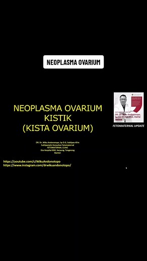 Neoplasma Ovarium: Kista dan Tumor yang Perlu Diketahui