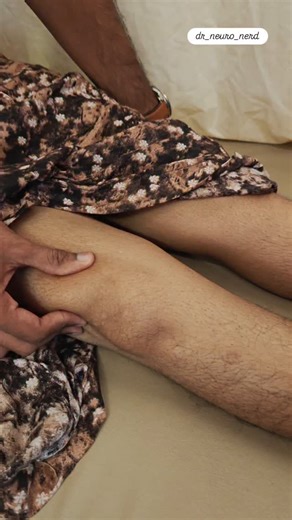 Dr M.Nirumal Khumar(Neuro nerd) | Quite an interesting clinical sign. Whats the significance ? (Clinical signs, neurology)... | Instagram