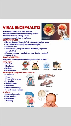 #healthcare #medical #nursing #encephalitis | Ma Vickie