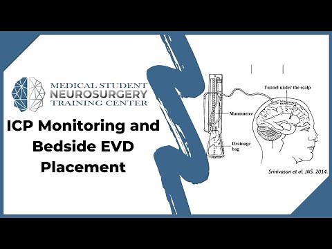 ICP Monitoring and Bedside EVD Placement