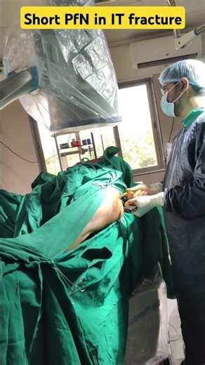 Short PFN in IT Fracture Live #Hip fracture#fracture operation#Proximal Femoral Nail in hip fracture