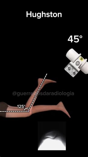 João Paulo Guerreiro e Elienes Gomes | Já fez esse exame? 📚☢️ A diferença do axial de patela 🔥🚀☢️ Segue pra não perder nada 📚☢️ #radiologia #tevejopordentro #radiologiaporamor | Instagram