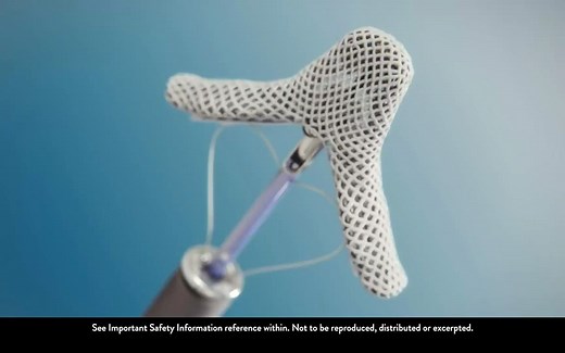 Transcatheter Mitral Valve Repair with MitraClip™ G4 雅培二尖瓣修复架子手术动画