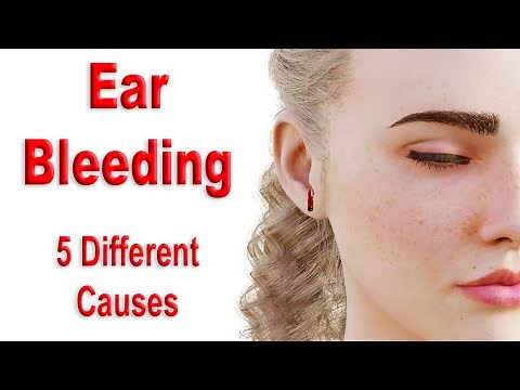 Ear Bleeding!!! 5 Different and Common Causes Shown