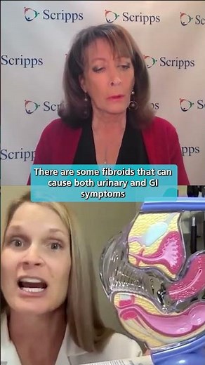 Uterine Fibroids: How to Diagnose and Treat