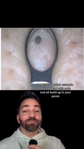 150K views · 879 reactions | 4k #dermdoctor | Doctorly | Facebook