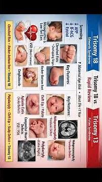 Trisomy 18 vs. 13: The Rapid Comparison
