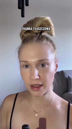 Guziki piezogeniczne (ang. piezogenic papules) to drobne, miękkie, najczęściej niebolesne uwypuklenia skóry, które zwykle pojawiają się na piętach, rzadziej na nadgarstkach lub innych miejscach narażonych na nacisk. Są to przepukliny tkanki tłuszczowej, które uwidaczniają się pod wpływem ucisku lub obciążenia (np. stania, chodzenia, biegania). Najczęściej mają wygląd małych, białawych lub cielistych guzków. | Reha-fitness Julia Żurawska