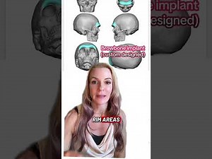 Facial Masculinization Surgery| Plastic Surgery| Facial Transformation