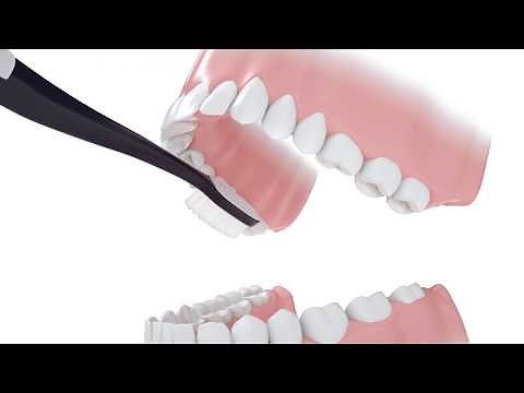 [라이브치과병원] 회전법 - 올바른 양치법