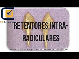 Retentores intra-radiculares