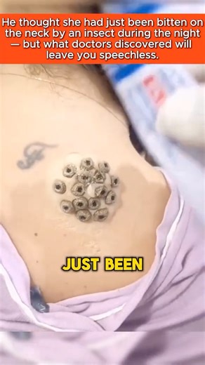 211K views · 1.3K reactions | He thought she had just been bitten on the neck by an insect during the night. But what doctors discovered will leave you speechless. #story #shockingstory #truestory #lifestory #realstory #storytime #storytelling #storyteller | True Stories | Facebook
