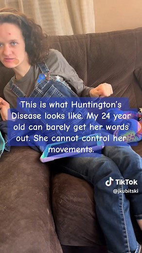 Huntington's Disease: Understanding the Impact