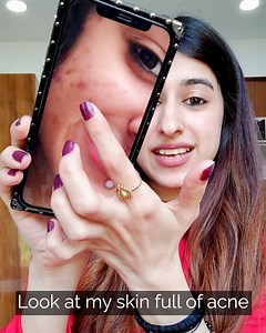 36 reactions | "Now the only thing on my face is glow." -Ashima I...