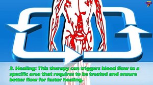 16 reactions · 19 shares | 5 Benefits of Cupping Therapy By Hijama...