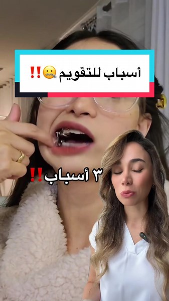 فوائد تقويم الأسنان باستخدام هيرس أبلاينس