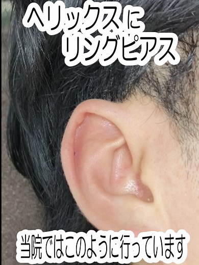 ヘリックスリリングピアスのトラブルを避ける方法