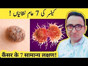 Don't Ignore These 7 Major Signs Of Cancer | 7 Common Symptoms Of Cancer!