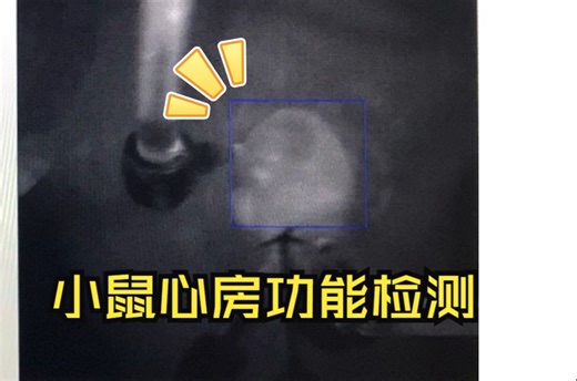 荧光标测技术（Optical Mapping）记录分析小鼠心房电活动