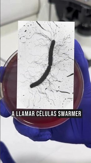 🦠 Proteus mirabilis and the Swarming Phenomenon Explained | Clinical Microbiology. #iamgalileo