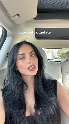 Forehead Baby Botox: 2-Week Update
