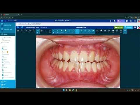 Gesden - Pack Premium One