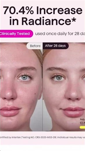 Mask, LED Face ,Light , #beauty #skin، #skincare، #skincareroutine https://amzn.to/3RedE5M