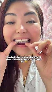 Cleaning my teeth and Invisalign aligners after 24Hrs