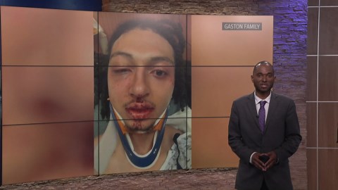 Amazon worker suffers serious injuries after video shows beating while security looked on