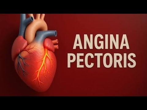 Angina pectoris 